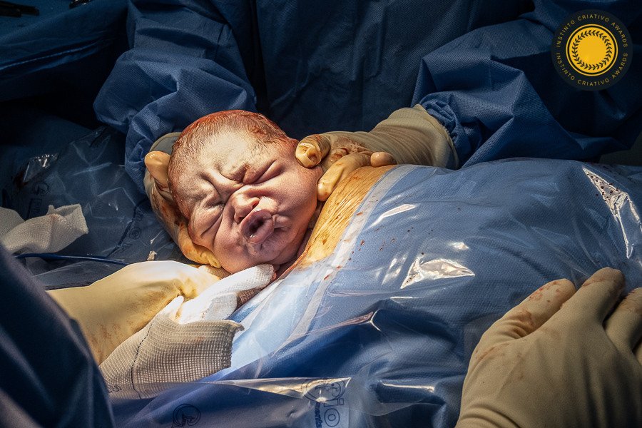 Erika A V Cabral - Concurso de Parto 4º Round - 2025