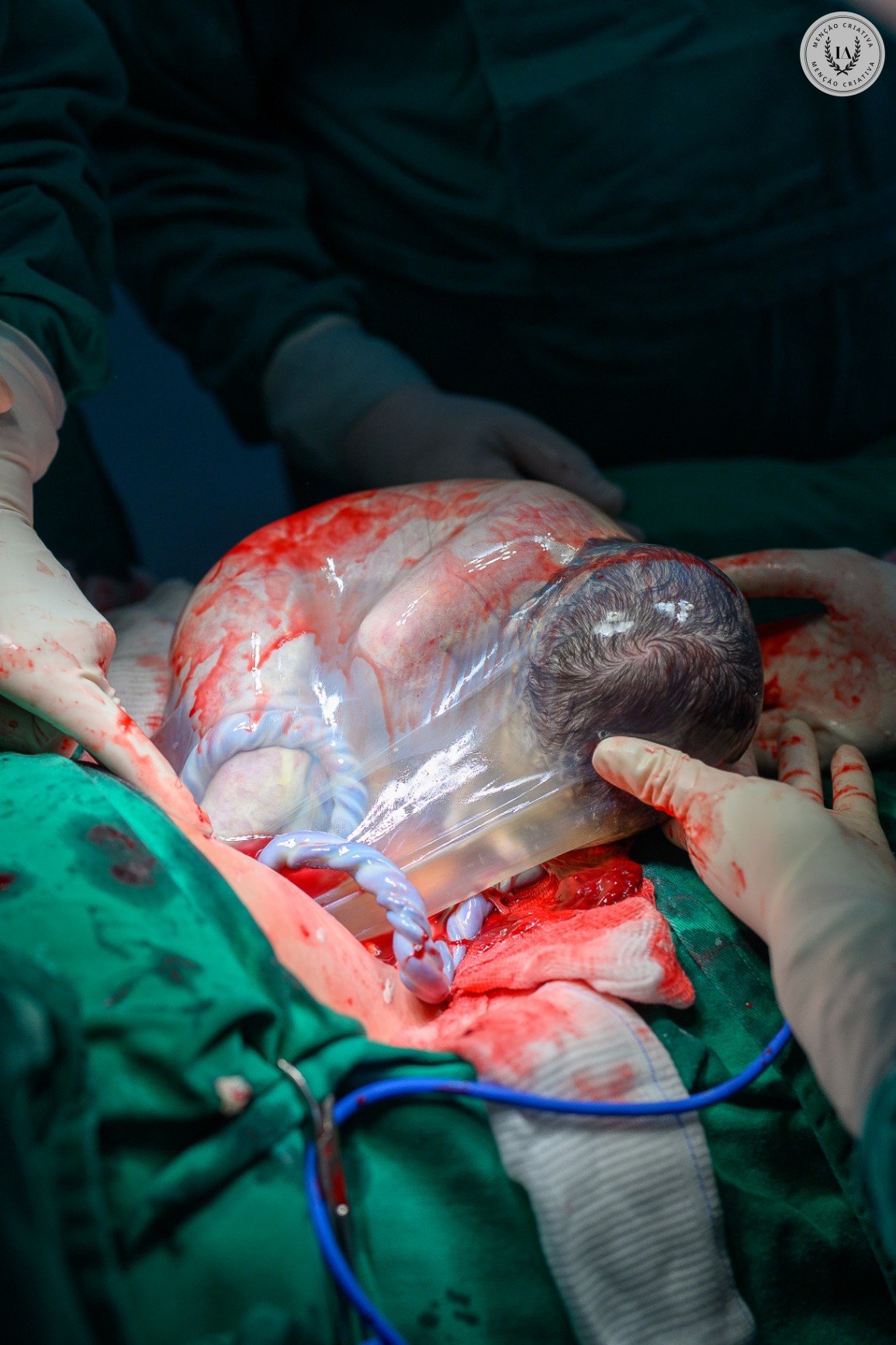 Andreza Ferreira - Concurso de Parto 1º Round - 2025