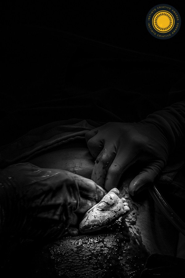 Erick Silva - Concurso de Parto 1º Round - 2025