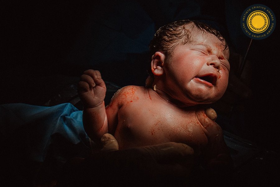 Erick Silva - Concurso de Parto 1º Round - 2025