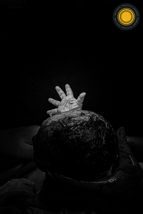 Erick Silva - Concurso de Parto 1º Round - 2025