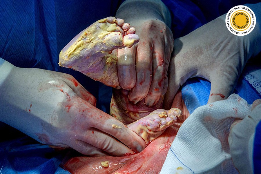 Paula Ingrid Da Cunha Galvao - MaternityParto 3º Round - 2025