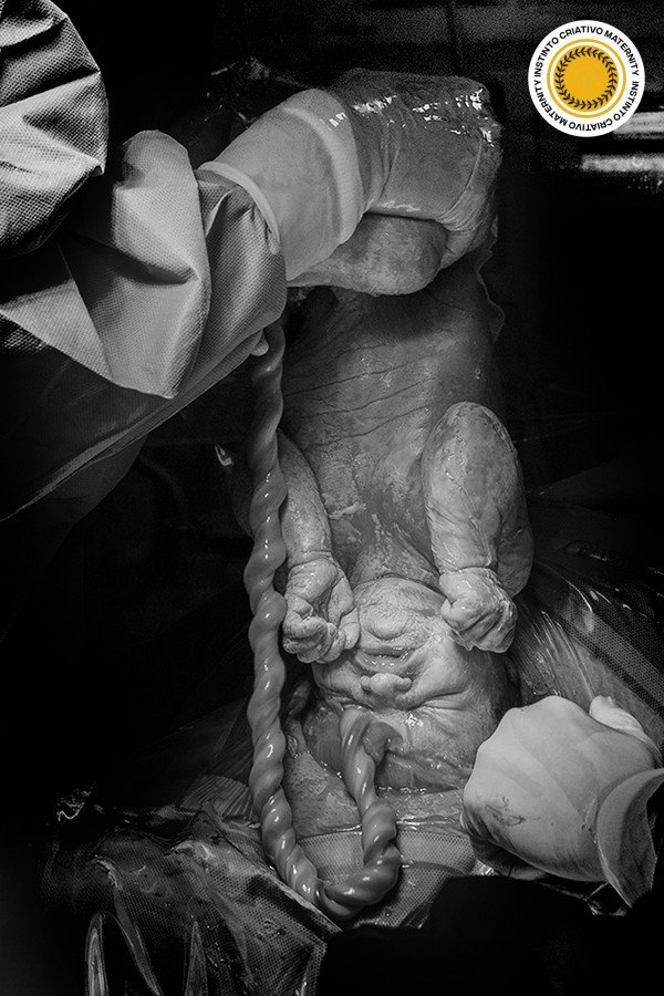 Paula Ingrid Da Cunha Galvao - MaternityParto 3º Round - 2025