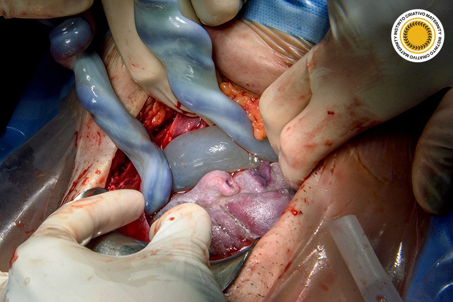 Paula Ingrid Da Cunha Galvao - MaternityParto 3º Round - 2025