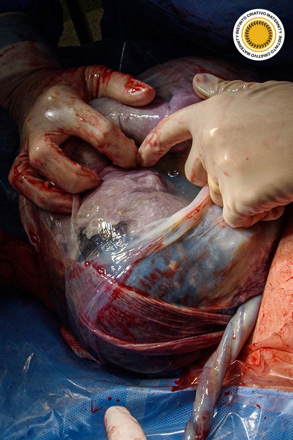 Paula Ingrid Da Cunha Galvao - MaternityParto 3º Round - 2025