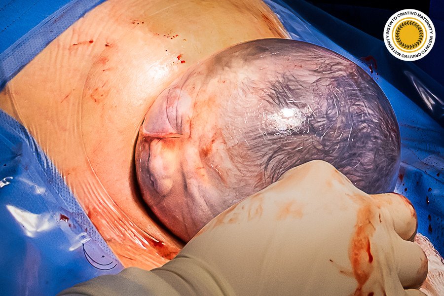 Alessandra Corveloni - MaternityParto 4º Round - 2025