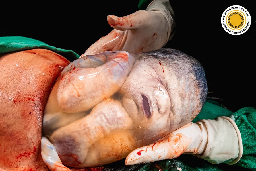 Erika A V Cabral - MaternityParto 1º Round - 2026