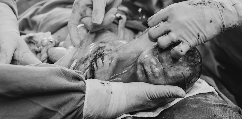 Banner de Rebeca Oliveira